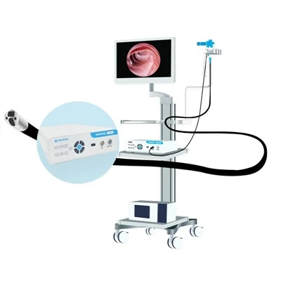 کلدوکوسکوپ ERCP